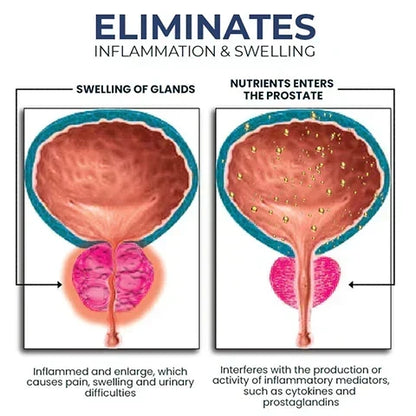 Alcuras™ Nasal Inhaler for Prostate Health-Regain Your Confidence✨